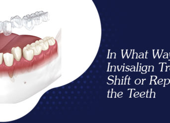 Invisalign Treatment