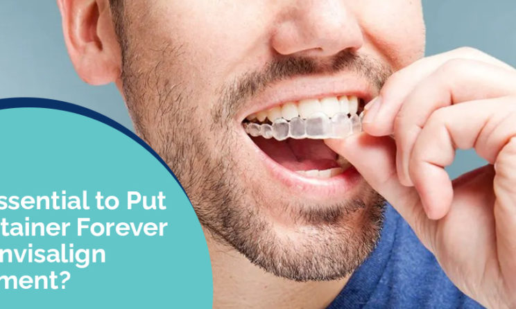 Invisalign Treatment