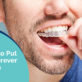 Invisalign Treatment